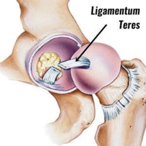 Australian Hip and Groin Clinic Australian Sports Physiotherapy