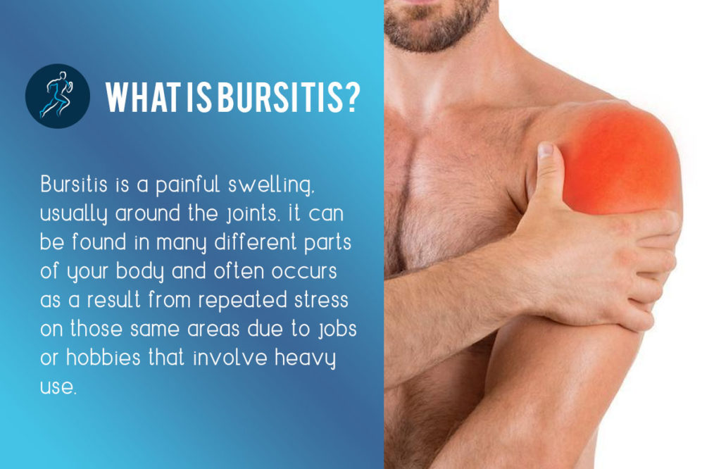 Physiotherapy for Bursitis