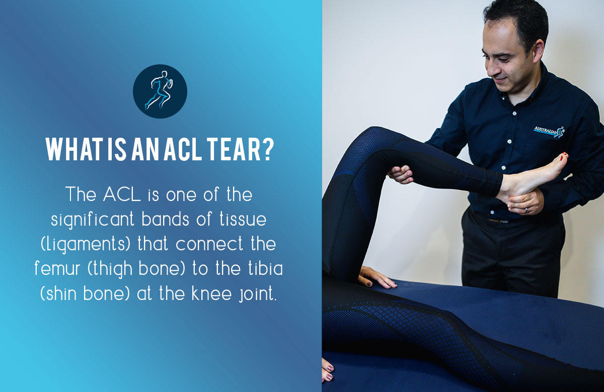 Physiotherapy for Anterior Cruciate Ligament (ACL) Injury