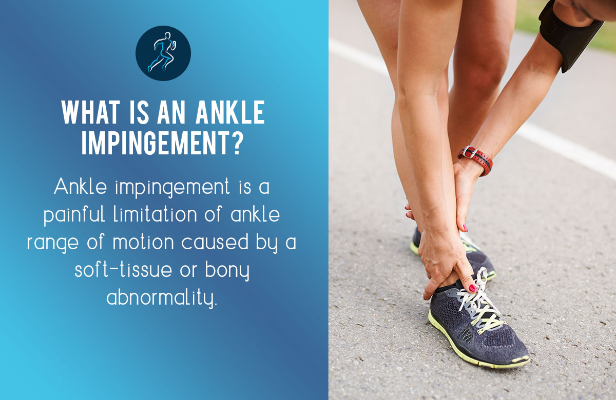 Physio for Ankle Impingement | Australian Sports Physio