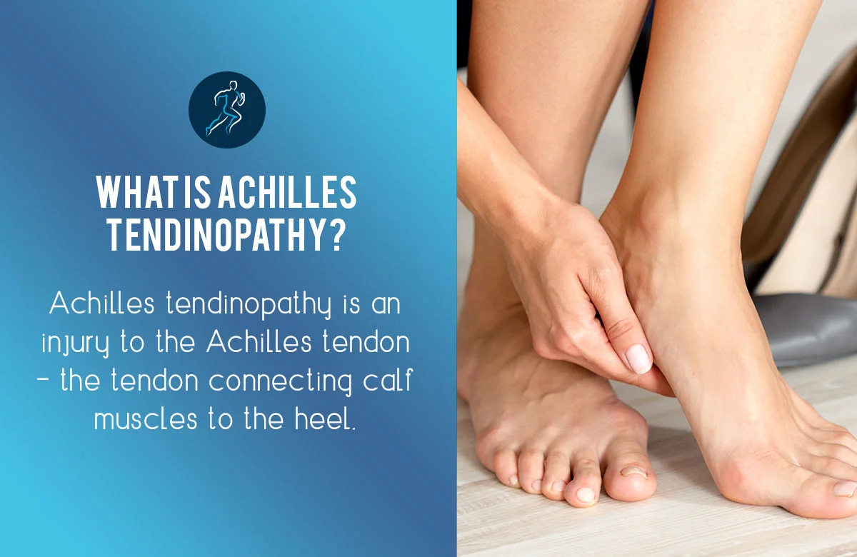 How to manage achilles tendinopathy