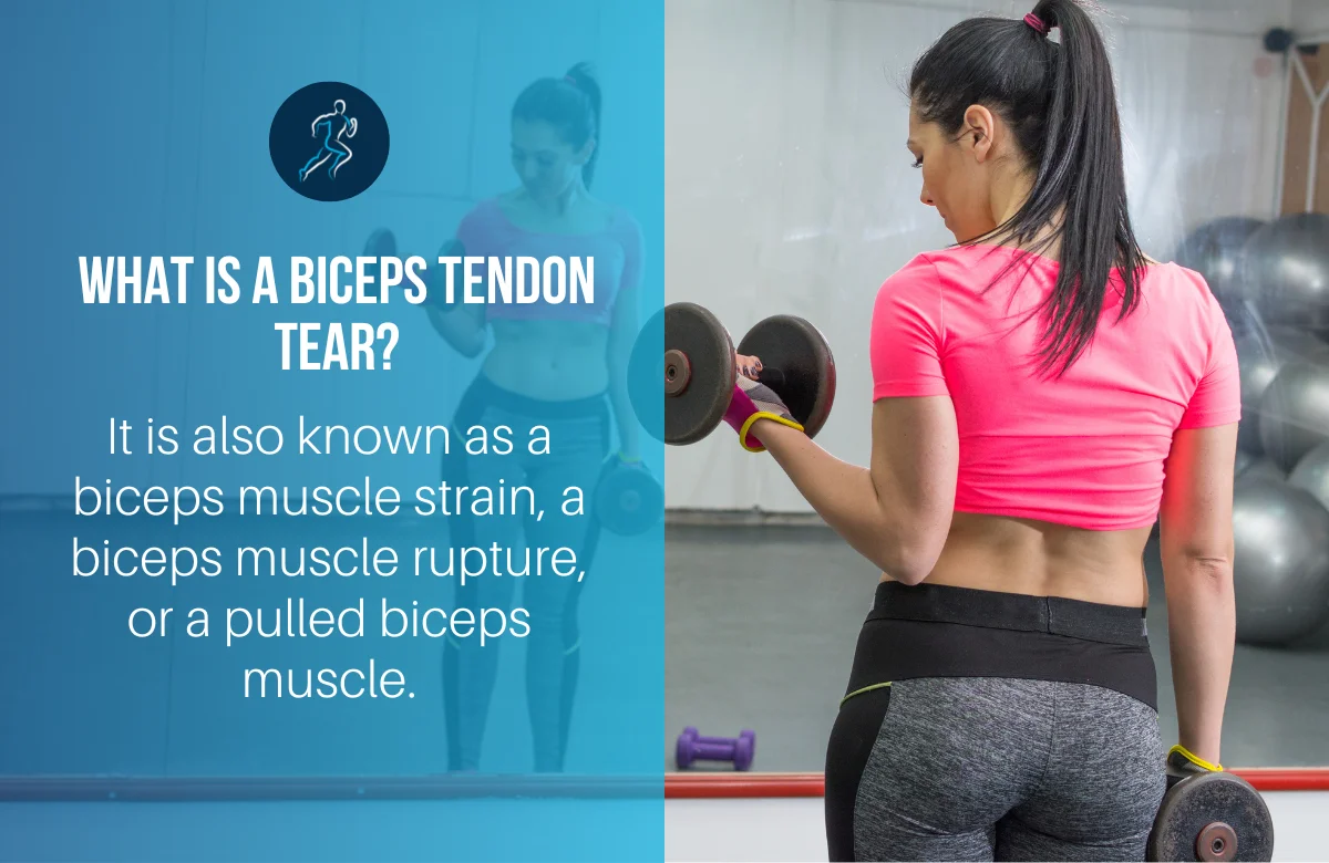 Bicep Tendon Tear Physiotherapy | Australian Sports Physiotherapy