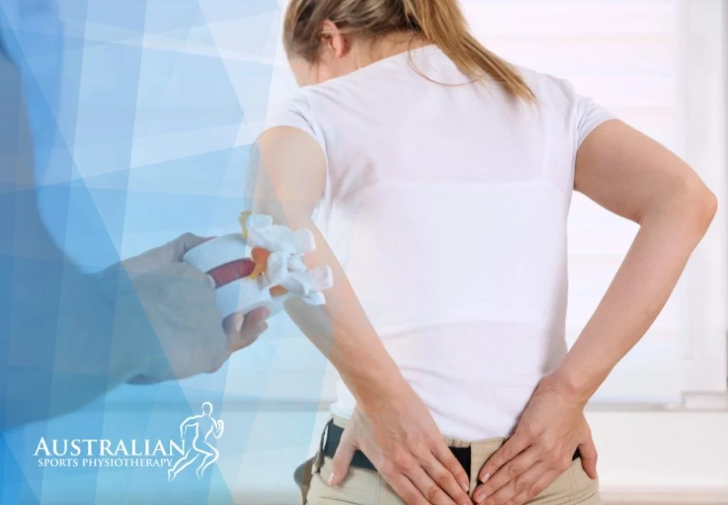 Physio Preston for Pinched Spinal Nerve - Spine Physiotherapy | Australian Sports Physiotherapy