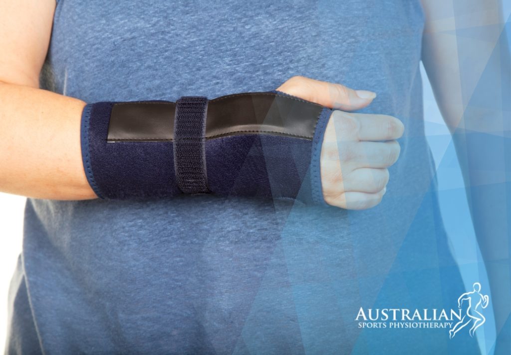 Physiotherapy For Scaphoid Fracture Australian Sports Physio 4747