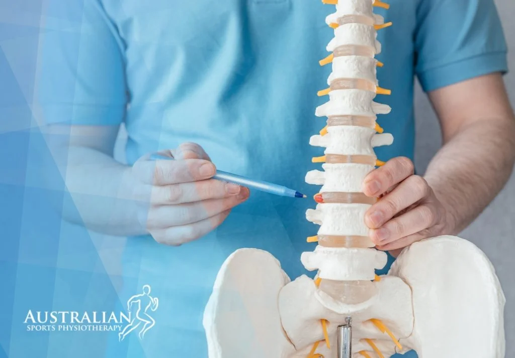 Coburg Physiotherapy for Bulging Disc | Australian Sports Physiotherapy