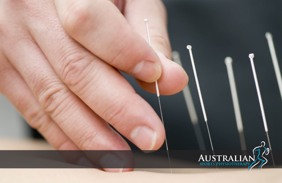 Dry Needling Service and Treatment Ivanhoe | Australian Sports Physiotherapy