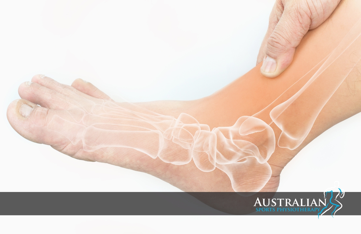 Coburg Physiotherapy for Bone Stress Injury | Australian Sports Physiotherapy